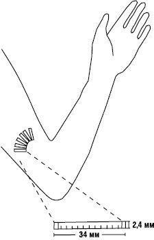 Implantacijni_terapevt_sys_1.eps