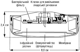 Implantacijni_terapevt_sys_2.eps